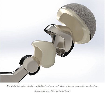 Project MaltaHip: When Ideas Become Reality